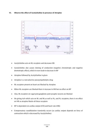 166
VI. Observe the effect of Acetylcholine in presence of Atropine
• Acetylcholine acts on M2 receptors and decreases HR
• Acetylcholine also causes slowing of conduction (negative chronotropic and negative
dromotropic effect), which in turn leads to decrease in BP
• Atropine followed by Acetylcholine is given
• Atropine is a non-selective parasympatholytic drug
• M2 receptors present on heart are blocked by Atropine
• When M2 receptors are blocked there is increase in HR but no effect on BP
• Also, M1 receptors on vagal post-ganglionic post-synaptic neuron are blocked
• On giving Ach which acts on M1 and M2 as well as Nm and Nn receptors, there is no effect
on HR as atropine blocks all these receptors
• BP is dependent on cardiac output (CO) and heart rate (HR)
• Compensatory vasodilatation transiently occurs (as cardiac output depends on force of
contraction which is decreased by Acetylcholine)
 