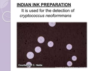 INDIAN INK PREPARATION
It is used for the detection of
cryptococcus neoformmans
 