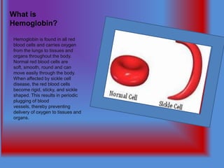 What is
Hemoglobin?

Hemoglobin is found in all red
blood cells and carries oxygen
from the lungs to tissues and
organs throughout the body.
Normal red blood cells are
soft, smooth, round and can
move easily through the body.
When affected by sickle cell
disease, the red blood cells
become rigid, sticky, and sickle
shaped. This results in periodic
plugging of blood
vessels, thereby preventing
delivery of oxygen to tissues and
organs.
 