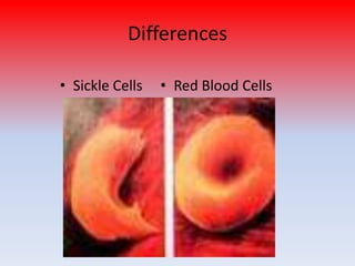Differences

• Sickle Cells   • Red Blood Cells
 