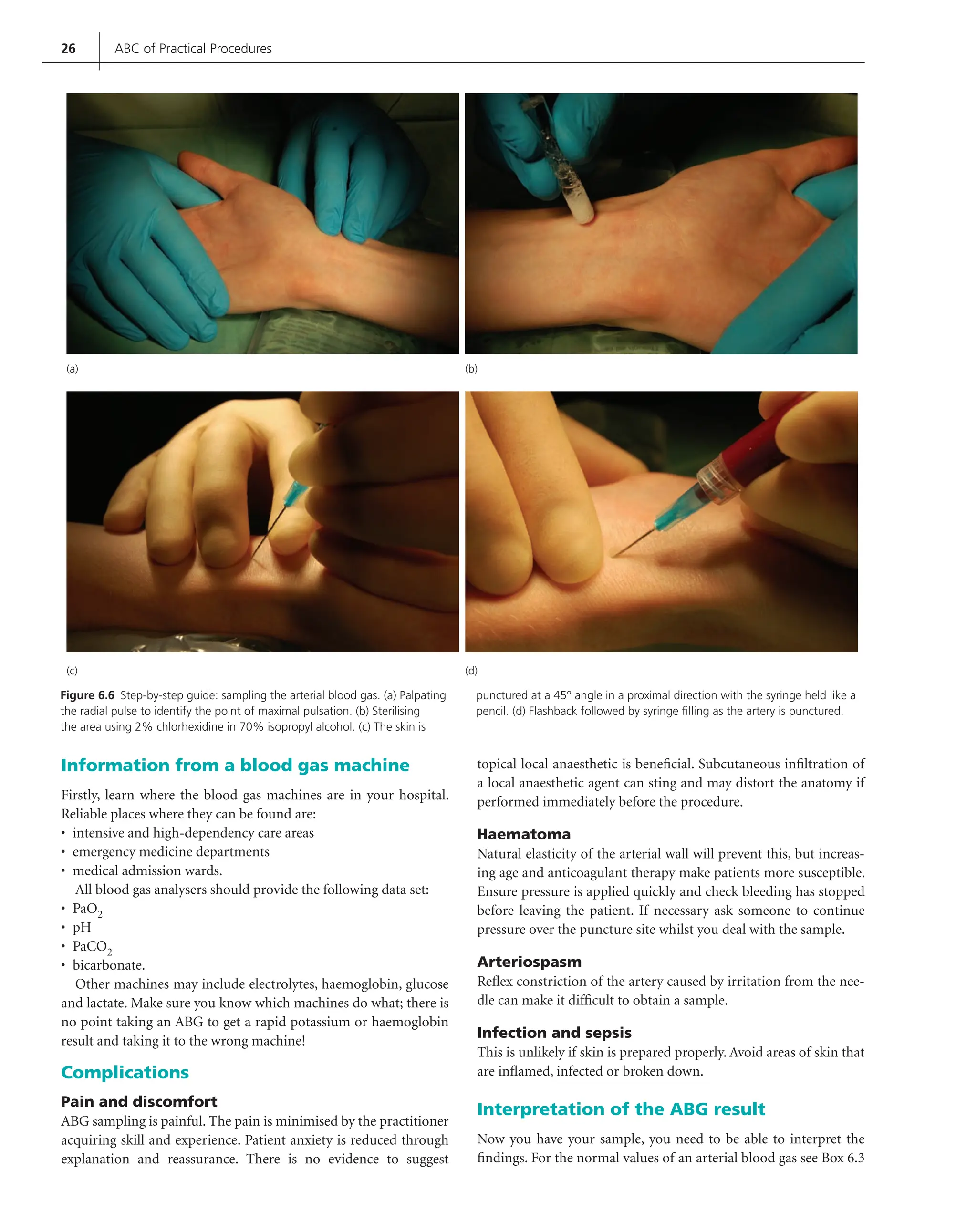Sampling Arterial Blood Gases Procedures | PDF