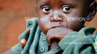 SEVERE ACUTE MALNUTRITION
PRESENTED BY: SREETAMA CHOWDHURY
CHAIRPERSON: DR. SHIBANI PAL
 