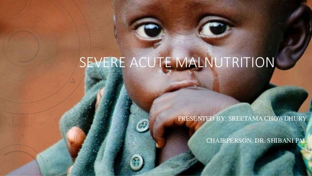 Severe acute malnutrition ppt Severe acute malnutrition ppt