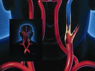 Brain Attack! Stroke is a “Brain Attack.” Stroke happens in the brain not the heart Stroke is an emergency.  Call 911 for emergency treatment. 