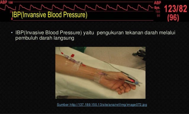 Patien Monitor Teknik Elektromedik Surabaya