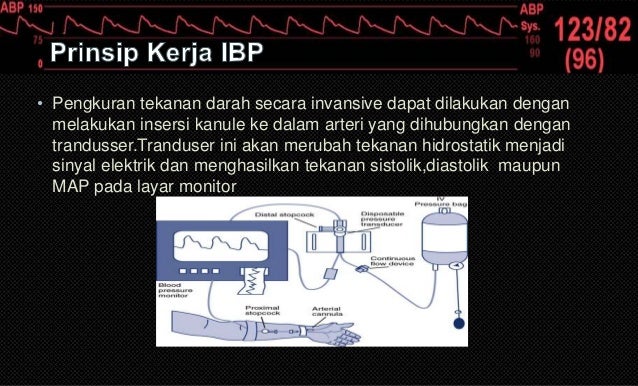 Patien Monitor Teknik Elektromedik Surabaya