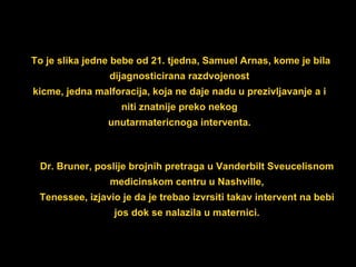 To je slika jedne bebe od 21. tjedna, Samuel Arnas, kome je bila dijagnosticirana razdvojeno st kicme, jedna malforacija, koja ne daje nadu u prezivljavanje a i niti znatnije preko nekog unutarmatericnoga interventa. Dr. Bruner, poslije brojnih pretraga u Vanderbilt Sveucelisnom medicinskom centru u Nashville, Tenessee, izjavio je da je trebao izvrsiti takav intervent na bebi jos dok se nalazila u maternici. 