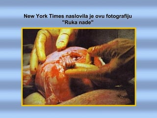 New York Times naslovila je ovu fotografiju "Ruka nade" 
