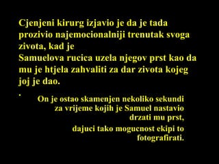 Cjenjeni kirurg izjavio je da je tada prozivio najemocionalniji trenutak svoga zivota, kad je Samuelova rucica uzela njegov prst kao da mu je htjela zahvaliti za dar zivota kojeg joj je dao. . On je ostao skamenjen nekoliko sekundi za vrijeme kojih je Samuel nastavio drzati mu prst, dajuci tako mogucnost ekipi to fotografirati. 