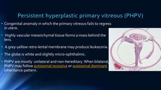 Pphpv Eye Differential diagnosis of congenital cataract | PPTX