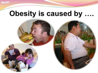 Obesity is caused by ….
SandFi
 