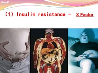 （1）Insulin resistance - X Factor
 Process’ refined food and additive cause insulin
insensitive
 Insensitivity of insulin cause carbohydrate turn to fat
SandFi
 