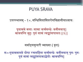 PUYA SRAVA
उत्तरस्थानम् - १०. सन्धिसितासितरोगविज्ञानीयाध्यायः
पूयास्रवे मलाः सास्रा वर्त्मसन्धेः कनीनकात्|
स्रावयन्ति मुहुः पूयं सास्रं त्वङ्मांसपाकतः||६||
सर्वाङ्गसुन्दरी व्याख्या ( कृत)
स०-पूयास्रवाख्ये दोषा रक्तसहिता वर्त्मसन्धेः कनीनकात् पुनः पुनः
पूयं सास्रं त्वङ्मांसपाकाद्धेतोः स्रावयन्ति|
 