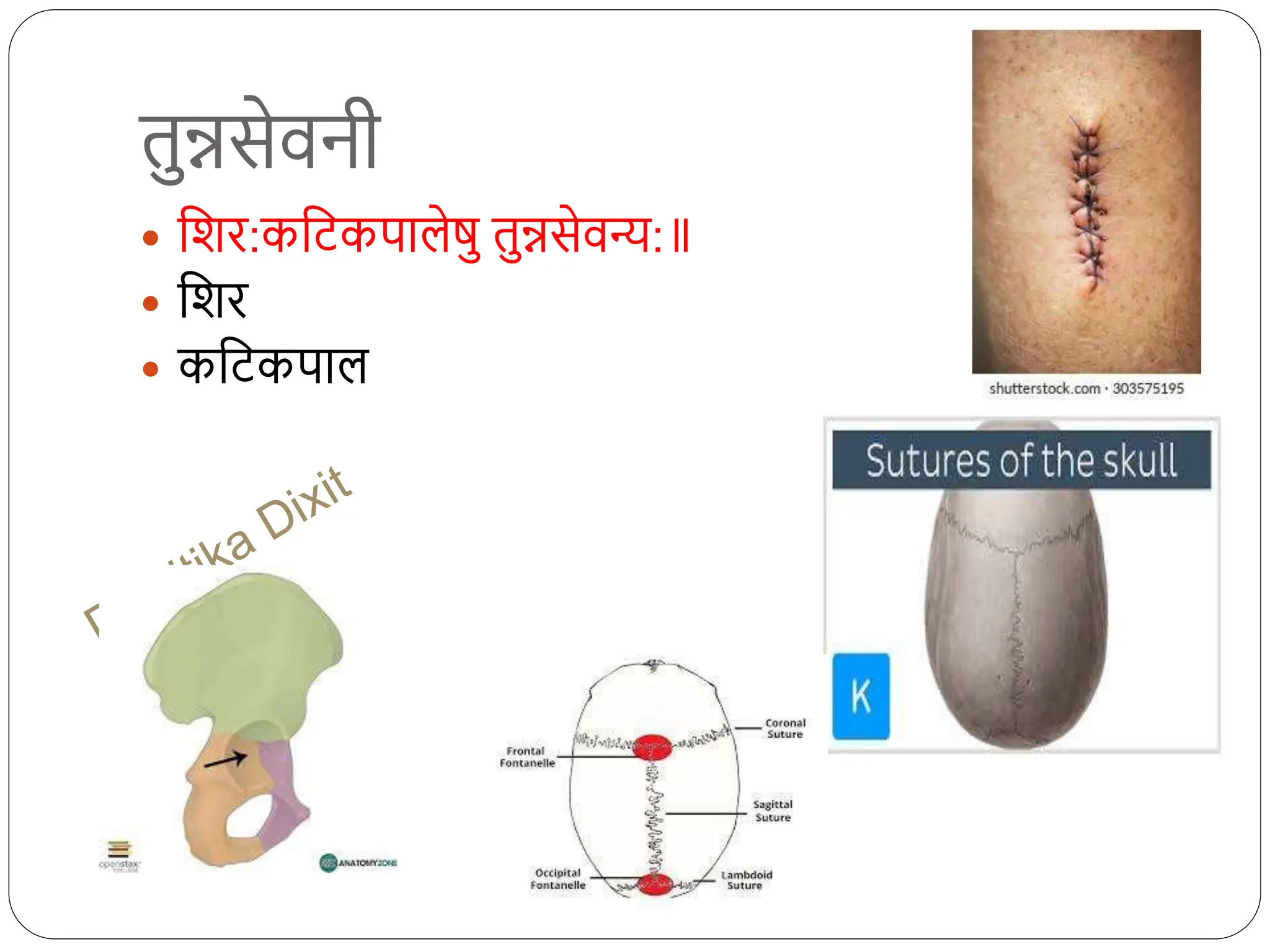 तुन्नसेवनी
 धशि:कधिकपालेषु तुन्नसेवन्य:
 धशि
 कधिकपाल
 