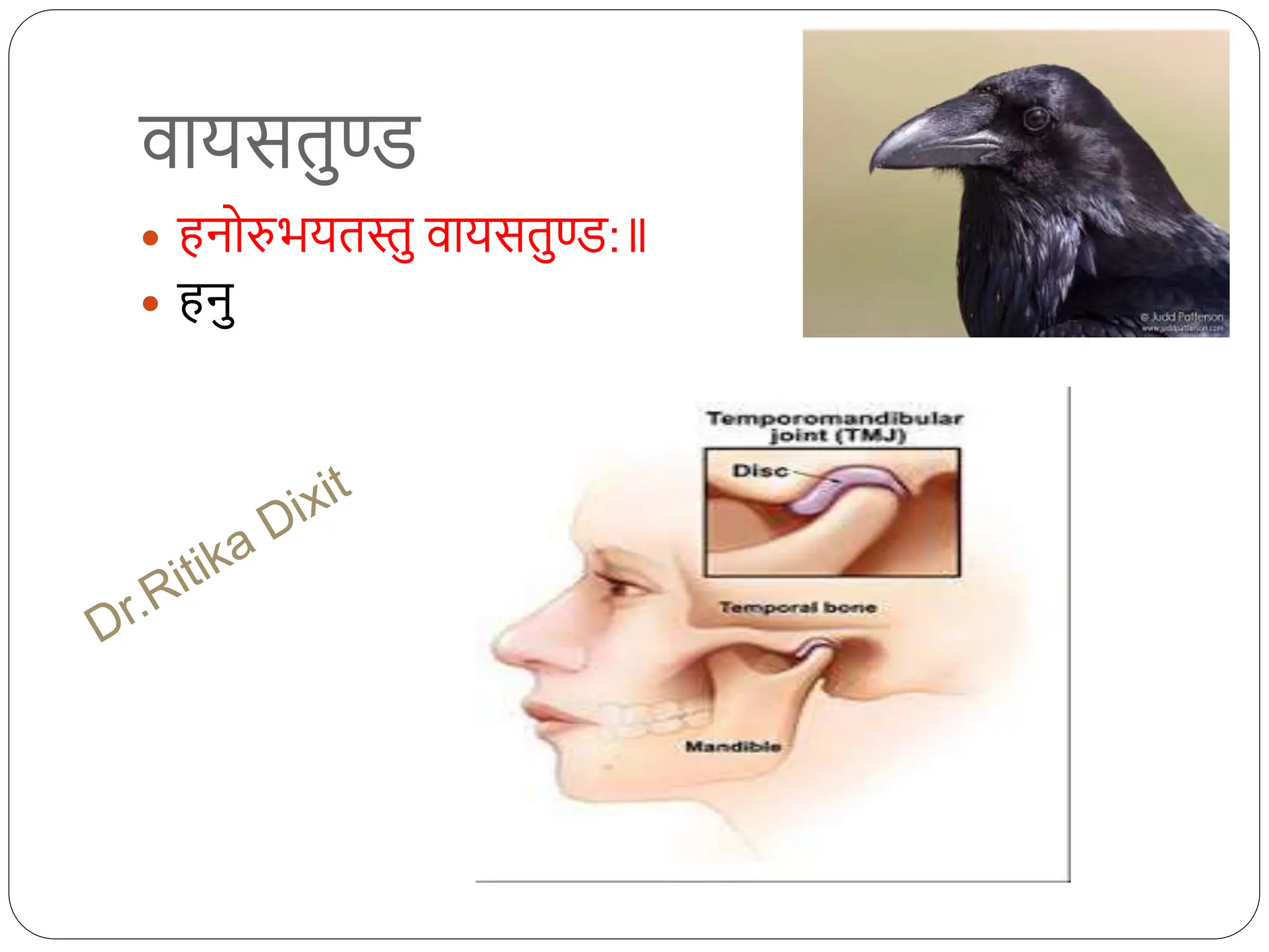 वायसतुण्ड
 हनोरुभयतस्तु वायसतुण्ड:
 हनु
 