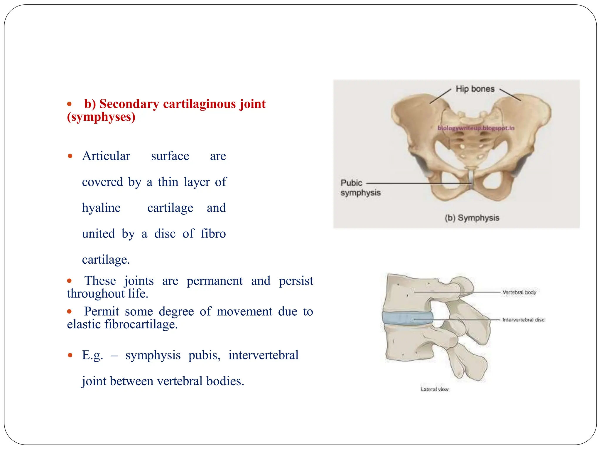  b) Secondary cartilaginous joint
(symphyses)
 Articular surface are
covered by a thin layer of
hyaline cartilage and
united by a disc of fibro
cartilage.
 These joints are permanent and persist
throughout life.
 Permit some degree of movement due to
elastic fibrocartilage.
 E.g. – symphysis pubis, intervertebral
joint between vertebral bodies.
 