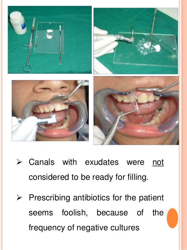 INTRACANAL MEDICAMENTS IN ENDODONTICS