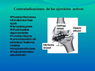 •  Procesos infecciosos e inflamatorios en fase aguda. • Hemopatías graves. • Miocardiopatías descompensadas. • Tumores malignos. • La no colaboración del paciente por trastornos mentales. • Anquilosis articulares.  • Fracturas recientes o pseudoartrosis  Contraindicaciones  de los ejercicios  activos Capsula articular Cartílago dañado Membrana sinovial 