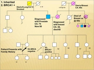 27
8/1 Diagnosed
with breast
CA. 48,
died 60
Died of
Breast ca
@ 50s
Died ofBreast
CA.40s
Patient Presents with
Family History
55,BRCA
negative
47
3235
d.MI @ 40s
53,
BRCA1
positive
52 50 45
1. Inherited
2. BRCA1 + d. 92Died ofLung CA 72
Smoked
Diagnosed
with Prostate
CA. 75
Now 80
 