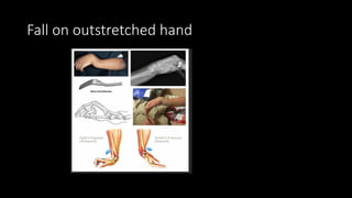 skeletal SYSTEM RADIOLOGY And associated findings.pptx
