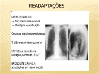 READAPTAÇÕES
 