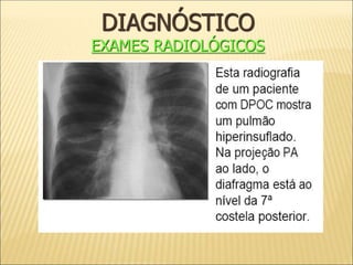 DIAGNÓSTICO
EXAMES RADIOLÓGICOS
 