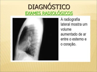 DIAGNÓSTICO
EXAMES RADIOLÓGICOS
 