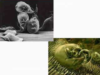 Cryptosporidium parvum
Giardia lamblia
 