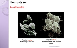 Hémostase
Les plaquettes
Franck Rencurel 2020
 