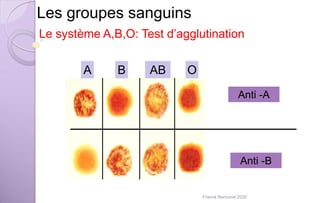 Les groupes sanguins
Le système A,B,O: Test d’agglutination
A B AB O
Anti -A
Anti -B
Franck Rencurel 2020
 