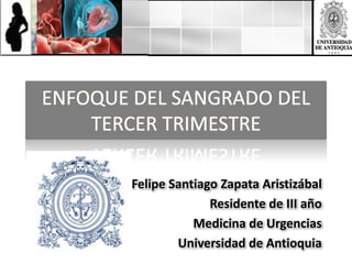 Felipe Santiago Zapata Aristizábal
              Residente de III año
           Medicina de Urgencias
        Universidad de Antioquia
 