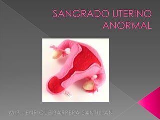SANGRADO UTERINO ANORMAL MIP.- ENRIQUE BARRERA SANTILLAN 