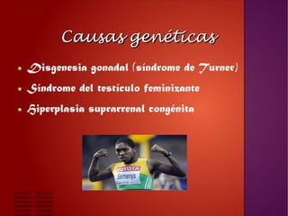 Causas genéticasCausas genéticas
● Disgenesia gonadal (síndrome de Turner)
● Síndrome del testículo feminizante
● Hiperpla...
