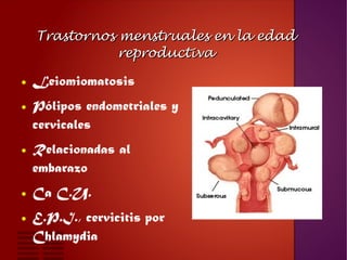 Trastornos menstruales en la edadTrastornos menstruales en la edad
reproductivareproductiva
● Leiomiomatosis
● Pólipos end...