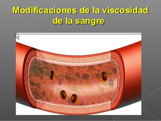 Sangre