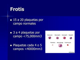 Frotis
 15 a 20 plaquetas por
campo normales
 3 a 4 plaquetas por
campo <75,000mm3
 Plaquetas cada 4 o 5
campos <40000mm3
 