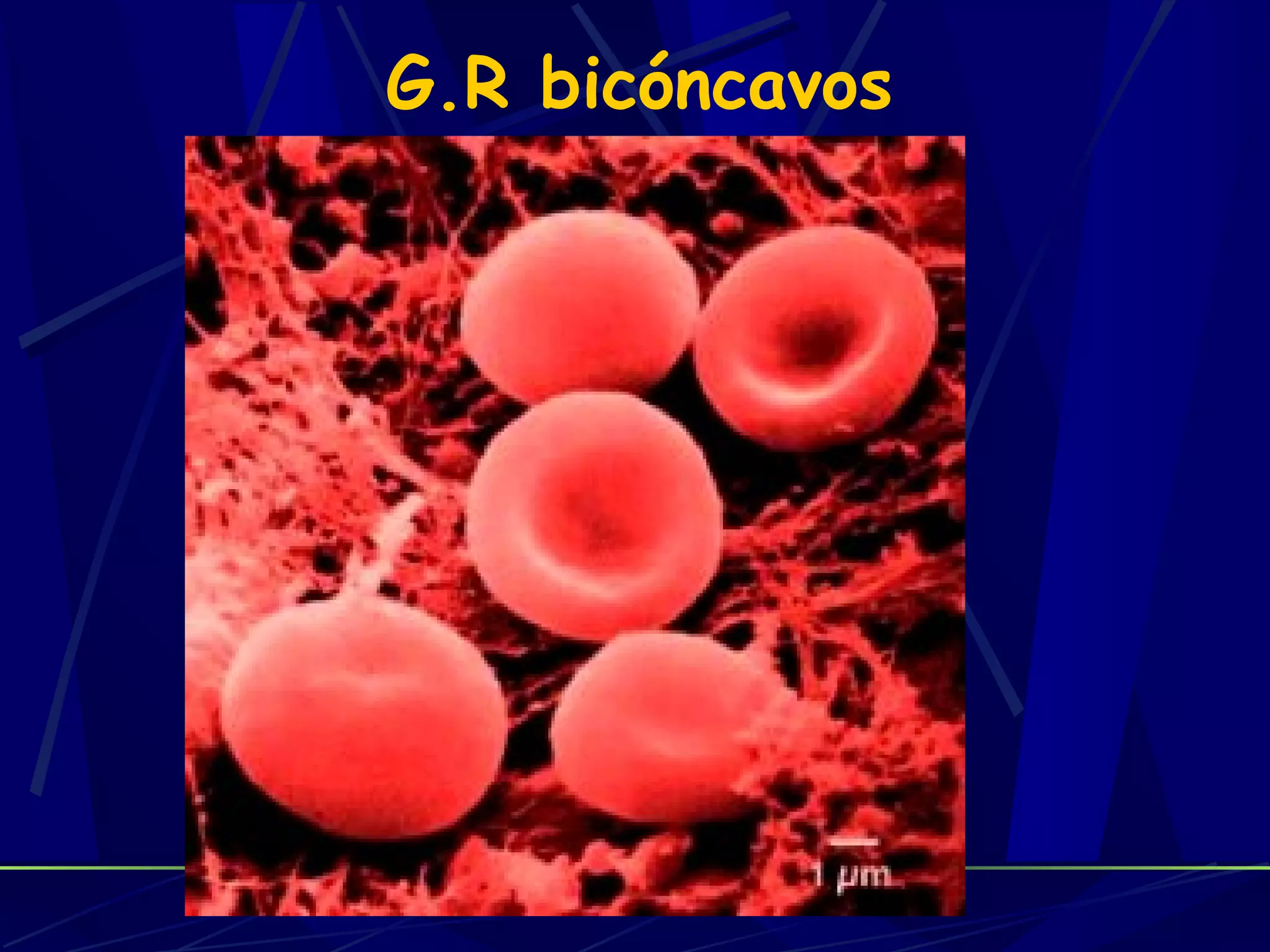 G.R bicóncavos
 