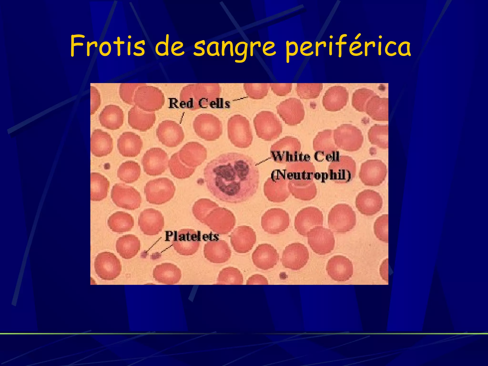 Frotis de sangre periférica
 