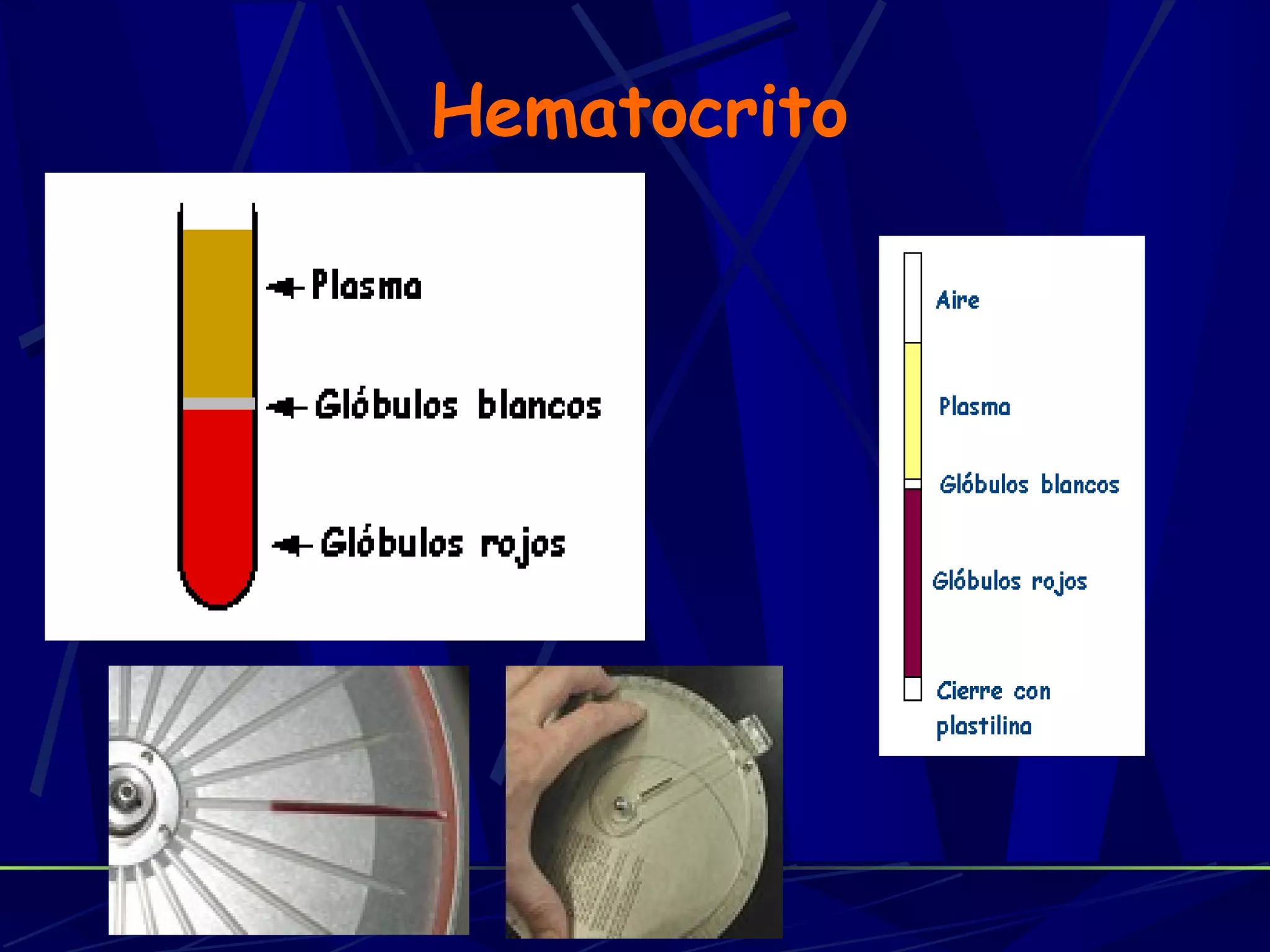 Hematocrito
 