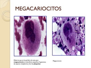 MEGACARIOCITOS




Observe que en la periferia de este gran           Megacariocito
megacariocito se identifican pequeños fragmentos
de aspecto citoplásmico. Son las plaquetas
 