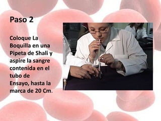 Paso 2
Coloque La
Boquilla en una
Pipeta de Shali y
aspire la sangre
contenida en el
tubo de
Ensayo, hasta la
marca de 20 Cm.
 