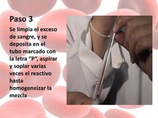 Paso 3
Se limpia el exceso
de sangre, y se
deposita en el
tubo marcado con
la letra “P”, aspirar
y soplar varias
veces el reactivo
hasta
homogeneizar la
mezcla
 