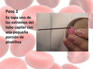 Paso 2
Se tapa uno de
los extremos del
tubo capilar con
una pequeña
porción de
plastilina
 