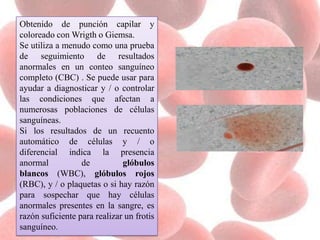 Obtenido de punción capilar y
coloreado con Wrigth o Giemsa.
Se utiliza a menudo como una prueba
de seguimiento de resultados
anormales en un conteo sanguíneo
completo (CBC) . Se puede usar para
ayudar a diagnosticar y / o controlar
las condiciones que afectan a
numerosas poblaciones de células
sanguíneas.
Si los resultados de un recuento
automático de células y / o
diferencial indica la presencia
anormal de glóbulos
blancos (WBC), glóbulos rojos
(RBC), y / o plaquetas o si hay razón
para sospechar que hay células
anormales presentes en la sangre, es
razón suficiente para realizar un frotis
sanguíneo.
 