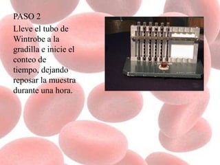 PASO 2
Lleve el tubo de
Wintrobe a la
gradilla e inicie el
conteo de
tiempo, dejando
reposar la muestra
durante una hora.
 