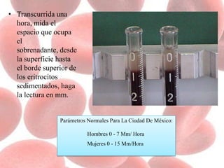 • Transcurrida una
hora, mida el
espacio que ocupa
el
sobrenadante, desde
la superficie hasta
el borde superior de
los eritrocitos
sedimentados, haga
la lectura en mm.
Parámetros Normales Para La Ciudad De México:
Hombres 0 - 7 Mm/ Hora
Mujeres 0 - 15 Mm/Hora
 
