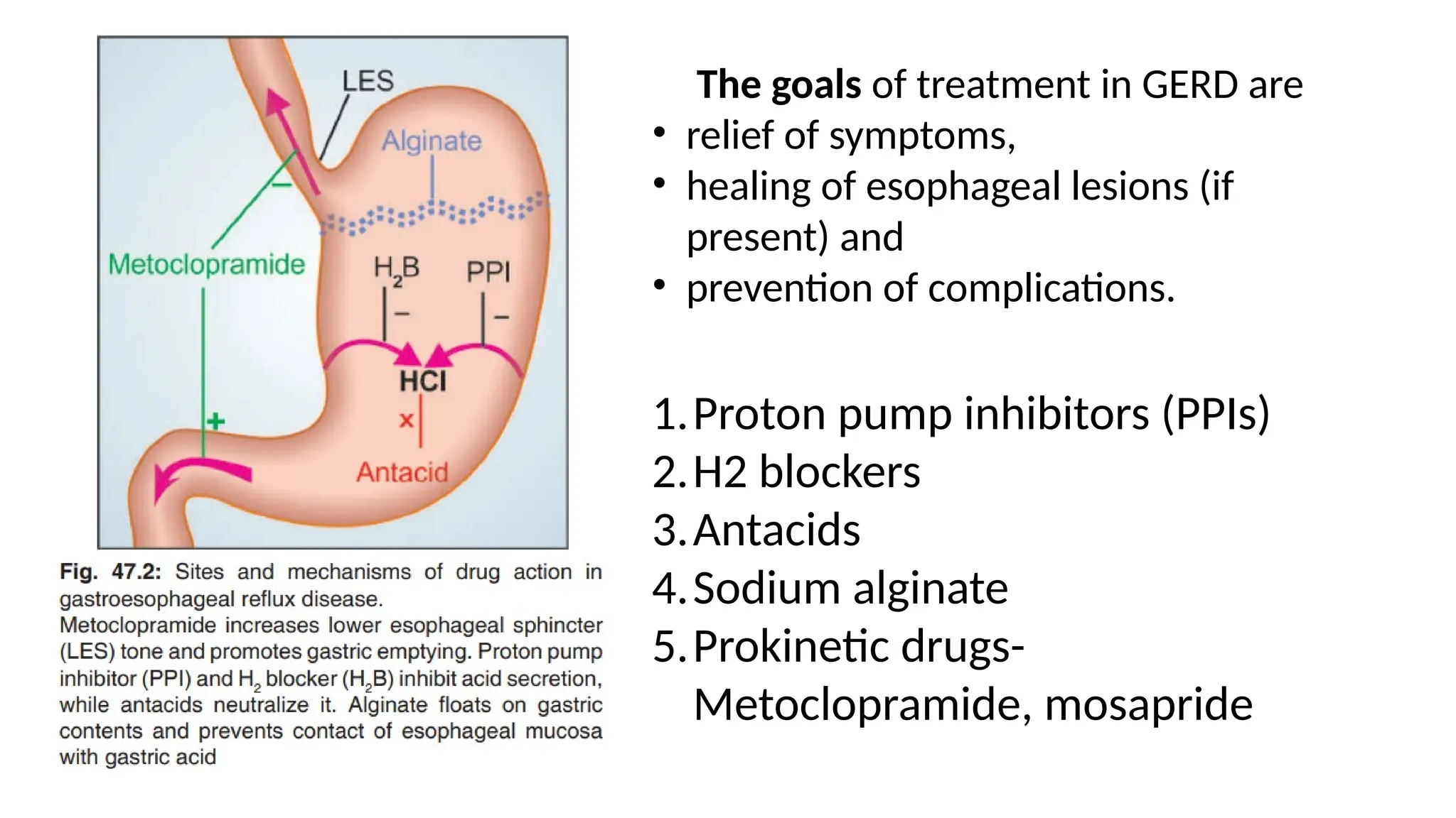 Gastrointestinal drugs and its adverse effects.pptx