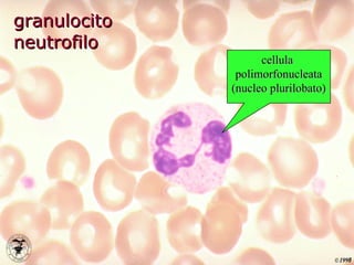 granulocito neutrofilo cellula  polimorfonucleata (nucleo plurilobato) 