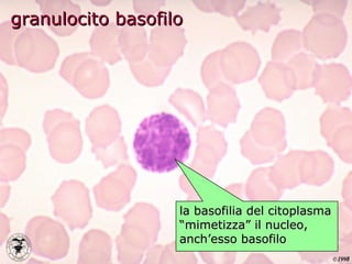 granulocito basofilo la basofilia del citoplasma “mimetizza” il nucleo, anch’esso basofilo 