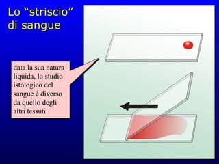 Lo “striscio” di sangue data la sua natura liquida, lo studio istologico del sangue è diverso da quello degli altri tessuti 